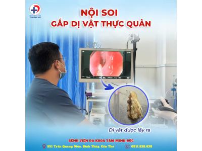 Nội soi gắp dị vật thực quản – Giải pháp an toàn và hiệu quả