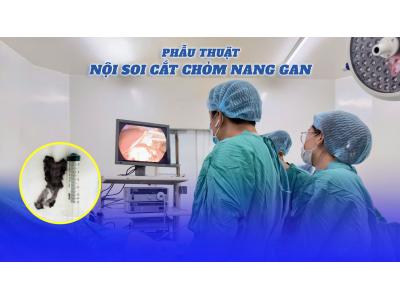 Phẫu thuật nội soi cắt chỏm nang gan 
